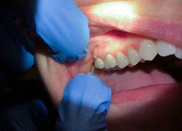 Best Emergency Dentist for Special Needs Patients in Franklin Furnace, OH